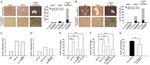 Original Article Collagen type VI regulates the CDK4/6-p-Rb signaling pathway and promotes ovarian cancer invasiveness, stemness, and metastasis