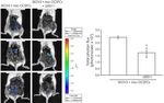 Original Article Collagen type VI regulates the CDK4/6-p-Rb signaling pathway and promotes ovarian cancer invasiveness, stemness, and metastasis