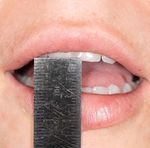 Dental advice for patients having radiotherapy and chemotherapy for head and neck cancer