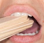 Dental advice for patients having radiotherapy and chemotherapy for head and neck cancer