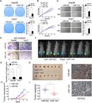 MIR-144-3P-MEDIATED DYSREGULATION OF EIF4G2 CONTRIBUTES TO THE DEVELOPMENT OF HEPATOCELLULAR CARCINOMA THROUGH THE ERK PATHWAY