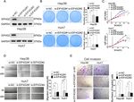 MIR-144-3P-MEDIATED DYSREGULATION OF EIF4G2 CONTRIBUTES TO THE DEVELOPMENT OF HEPATOCELLULAR CARCINOMA THROUGH THE ERK PATHWAY