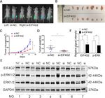 MIR-144-3P-MEDIATED DYSREGULATION OF EIF4G2 CONTRIBUTES TO THE DEVELOPMENT OF HEPATOCELLULAR CARCINOMA THROUGH THE ERK PATHWAY