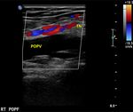 Ultrasonographic Evaluation of Nerves and Their Association with Veins in the Lower Limbs