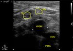 Ultrasonographic Evaluation of Nerves and Their Association with Veins in the Lower Limbs