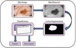 Automated Non-invasive Skin Cancer Detection using Dermoscopic Images