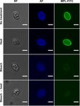 Effect of household bleach on the structure of the sporocyst wall of Toxoplasma gondii