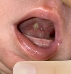 POST-OP FRENECTOMY HOME CARE GUIDE - Dr. Chelsea Pinto