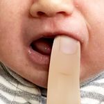 POST-OP FRENECTOMY HOME CARE GUIDE - Dr. Chelsea Pinto