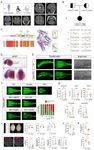 In-depth analysis reveals complex molecular aetiology in a cohort of idiopathic cerebral palsy - Oxford Academic Journals