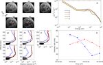 Types of pulsating aurora: comparison of model and EISCAT electron density observations