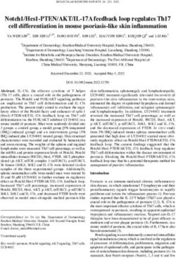 Notch1/Hes1 PTEN/AKT/IL 17A feedback loop regulates Th17 cell differentiation in mouse psoriasis like skin inflammation