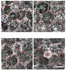 Characteristics of normal human retinal pigment epithelium cells with extremes of autofluorescence or intracellular granule count