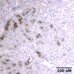 Activation of hypoxia-sensing pathways promotes renal ischemic preconditioning following myocardial infarction